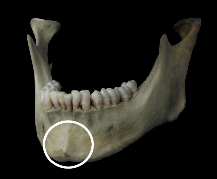 Fil:Human mandible mental protuberance.jpg